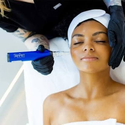 Skin Pen Microneedling at SkinnocenceLV in las vegas, NV